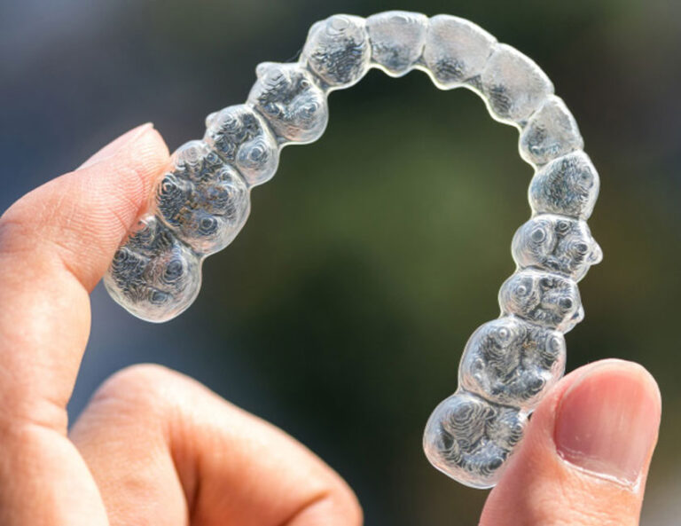 invisalign near you