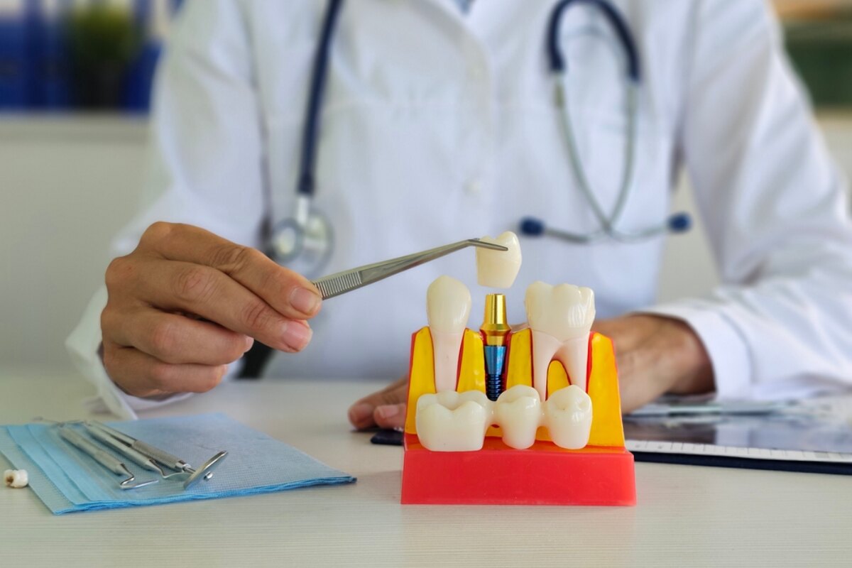 dental implants a permanent solution for missing teeth
