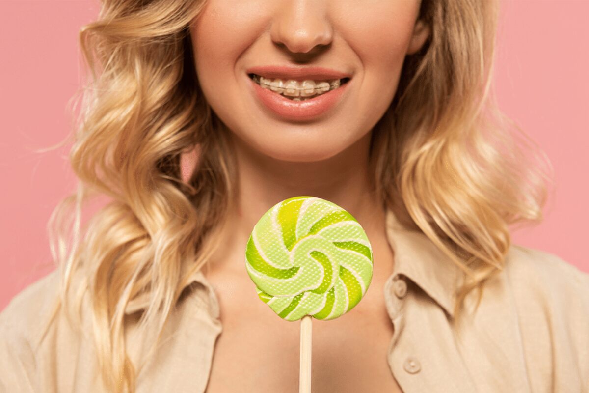 what to eat and what to avoid during invisalign treatment