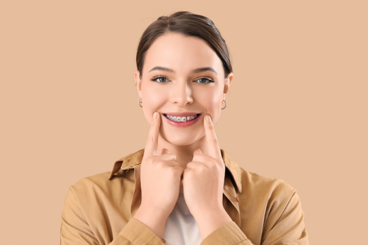 how a dentist in se calgary helps you achieve a perfect smile with braces