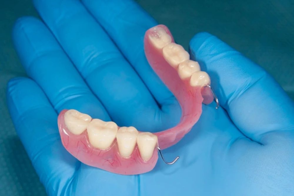 how to care for your partial dentures tips for long-term success